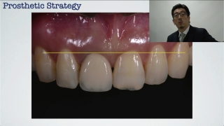 審美領域における包括的治療戦略の画像です。