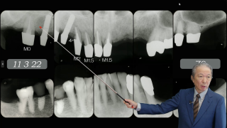 三種の神器が無くてもできるこれだけの治療！一般開業医だからできる「総合歯科診療」の画像です。