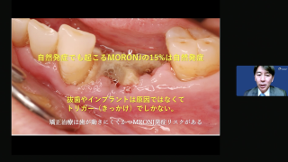 【埋入外科編】の画像です。