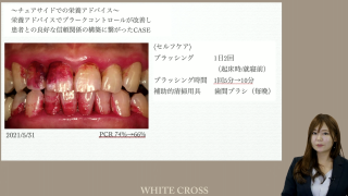 チェアサイドで活用したい！〜歯科衛生士からの栄養アドバイス〜の画像です。