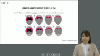 【第3回】睡眠歯科導入ノウハウの画像です。