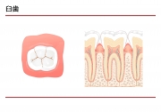 臼歯の説明の画像です。