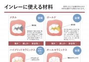 インレーに使える材料の画像です。