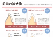 前歯の被せ物の画像です。